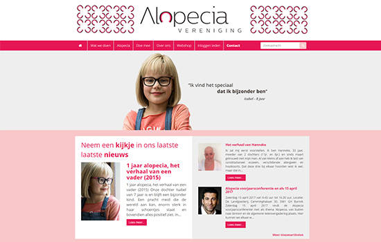 Alopecia vereniging.nl